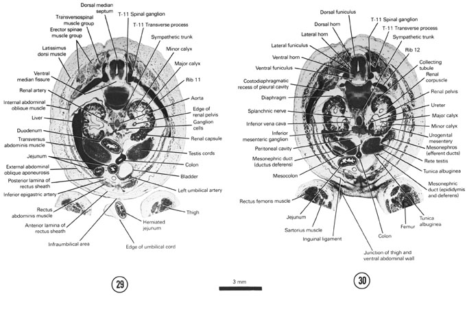 Open PDF version of FIG 8-17, A section through the caudal edge of the umbilical cord, liver and duodenum and the T-11 spinal ganglion. A section through the caudal part of the ventral abdominal wall, middle of the testis and T-11 spinal ganglion.