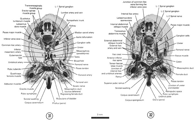 Open PDF version of FIG 8-18, A section through the phallus, caudal part of the testis and kidney and the L-1 spinal ganglion. A section through the glans penis, urethral plate and L-1 and L-2 spinal ganglia.