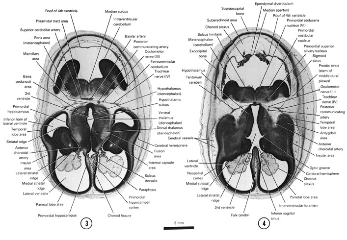 Open PDF version of FIG 8-4, A section through the cerebral hemispheres (insular area and parietal and temporal lobe areas) and middle of the diencephalon and metencephalon. A section through the cerebral hemispheres, hypothalamus and metencephalon.