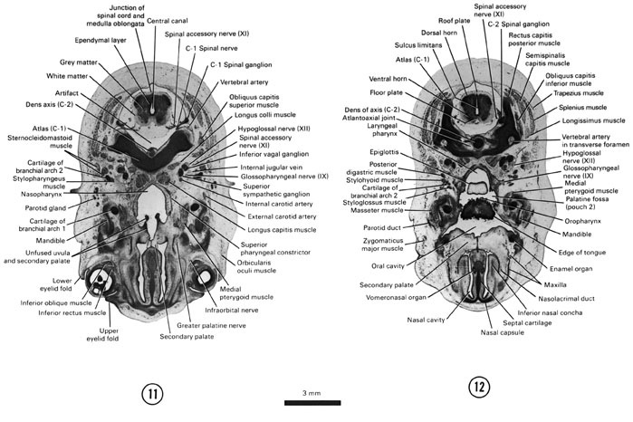 Open PDF version of FIG 8-8, A section through the caudal part of the secondary palate, junction of the medulla oblongata and the spinal cord and the C-1 spinal ganglion. A section through the dorsal edge of the tongue and the C-2 spinal ganglion.