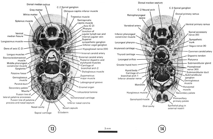 Open PDF version of FIG 8-9, A section through the rostral part of the nasal cavity and secondary palate. A section through the external nostrils, premaxillary palate, larynx and C-3 spinal ganglion. 