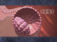 See Labels [Early Implantation]
