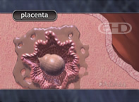 See Labels [Implantation Complete]