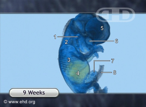 Feto de 9 Semanas, Animação MRI [Clique para a próxima imagem]