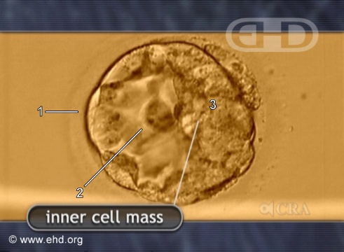 Blastocisto con masa celular interna [Haga clic para la siguiente imagen]