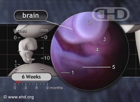 Cerebro y cordón umbilical [Haga clic para la siguiente imagen]