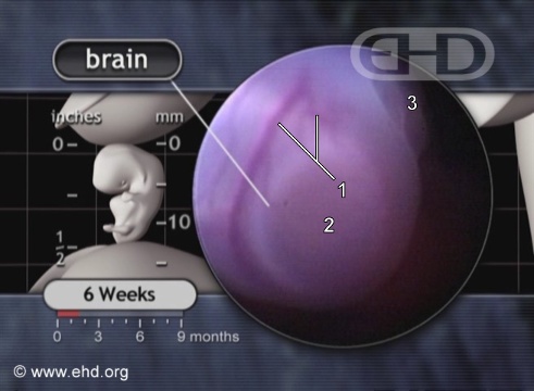 Primer plano de la cabeza: cerebro [Haga clic para la siguiente imagen]