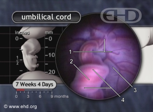 Primer plano del cordón umbilical [Haga clic para la siguiente imagen]