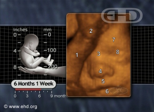 Rostro de feto de 25 semanas [Haga clic para la siguiente imagen]