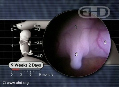Tubérculo genital a las 9 semanas y 2 días [Haga clic para la siguiente imagen]