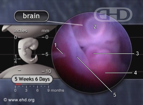 Corazón y cerebro [Haga clic para la siguiente imagen]