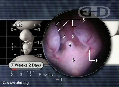 Embrión de abajo a las 7 semanas y 2 días [Haga clic para la siguiente imagen]
