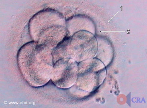 Mórula: Embrião de Doze Células [Clique para a próxima imagem]