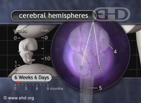 Modelo del cerebro por resonancia magnética [Haga clic para la siguiente imagen]