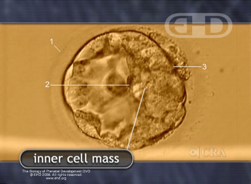 Blastocyst with Inner Cell Mass