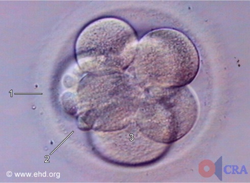 Embrión de siete células [Haga clic para la siguiente imagen]