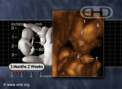 El feto de 14 semanas [Haga clic para la siguiente imagen]