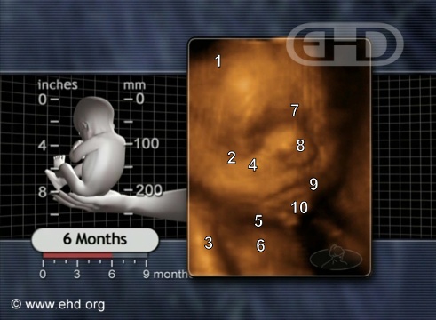 El rostro fetal de 6 meses [Haga clic para la siguiente imagen]