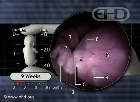O Feto de 9 Semanas [Clique para a próxima imagem]