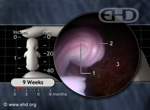 El cordón umbilical de 9 semanas [Haga clic para la siguiente imagen]