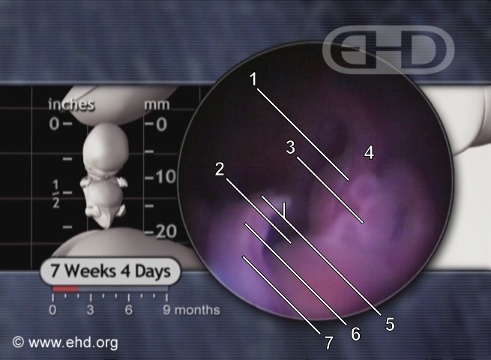 El cordón umbilical a las 7½ semanas [Haga clic para la siguiente imagen]