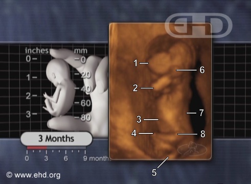 Feto de tres meses [Haga clic para la siguiente imagen]