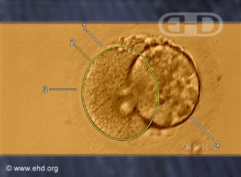 Embrión humano de dos células [Haga clic para la siguiente imagen]