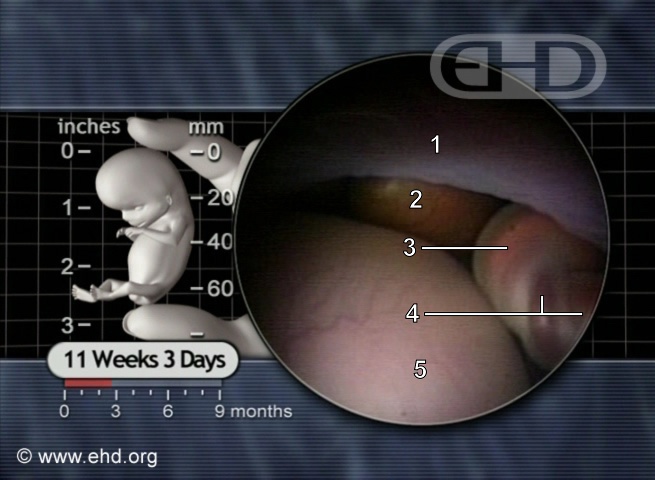Âmnio e Cordão Umbilical [Clique para a próxima imagem]