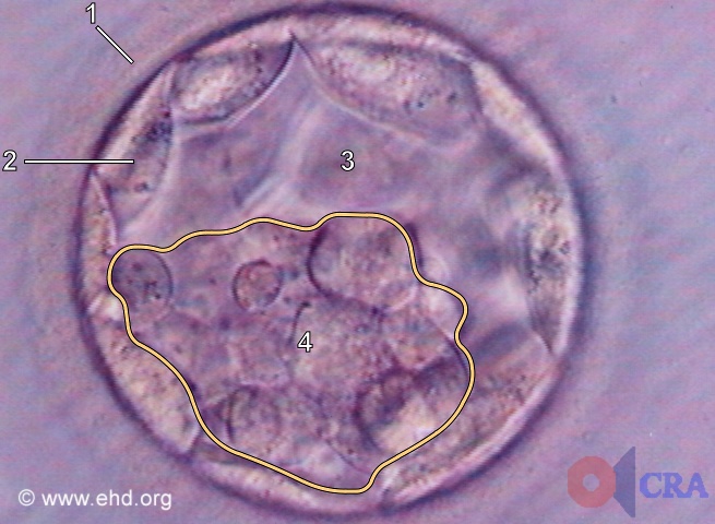Early Blastocyst [Click for next image]