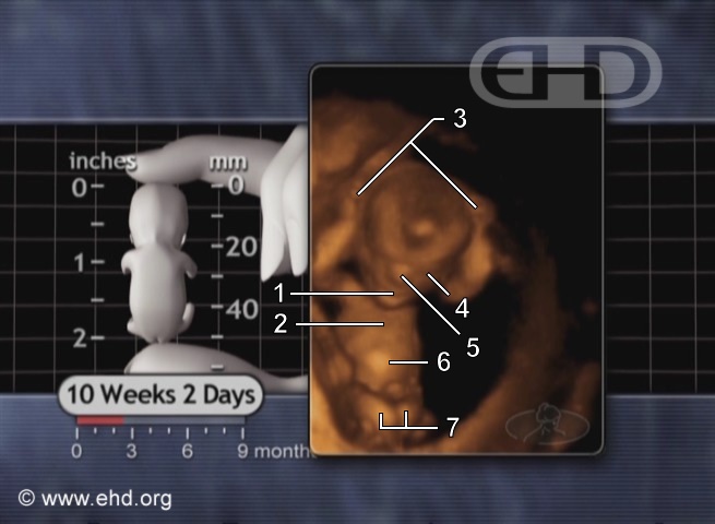Fetus, 10-Weeks [Click for next image]