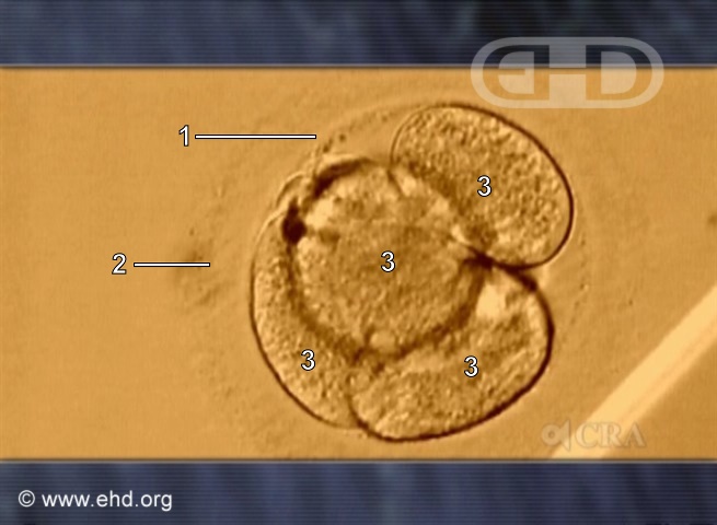 Embrião Humano de Quatro Células [Clique para a próxima imagem]