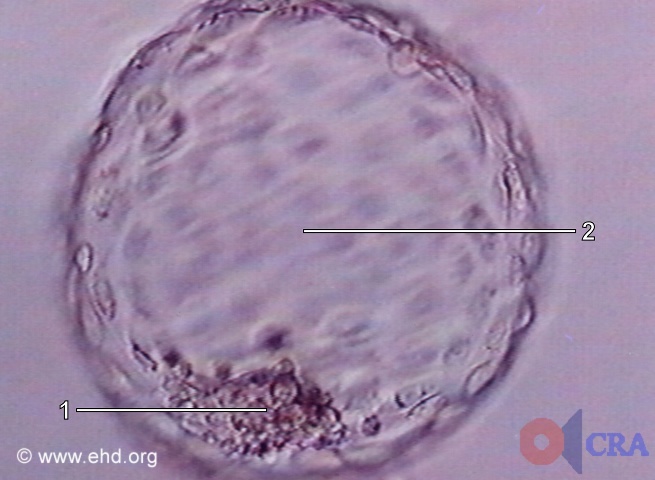 Blastocisto livre (sem zona) [Clique para a próxima imagem]
