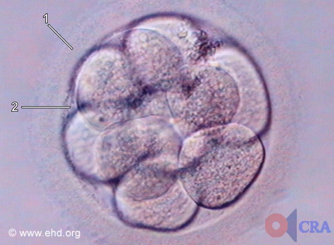 Embrión de diez células [Haga clic para la siguiente imagen]