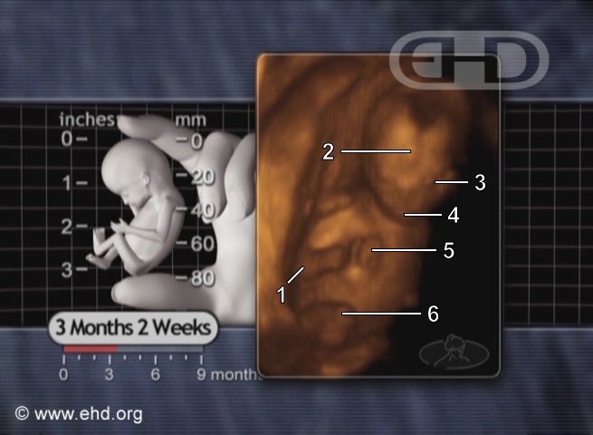 Um Feto de 3 ½ Meses [Clique para a próxima imagem]