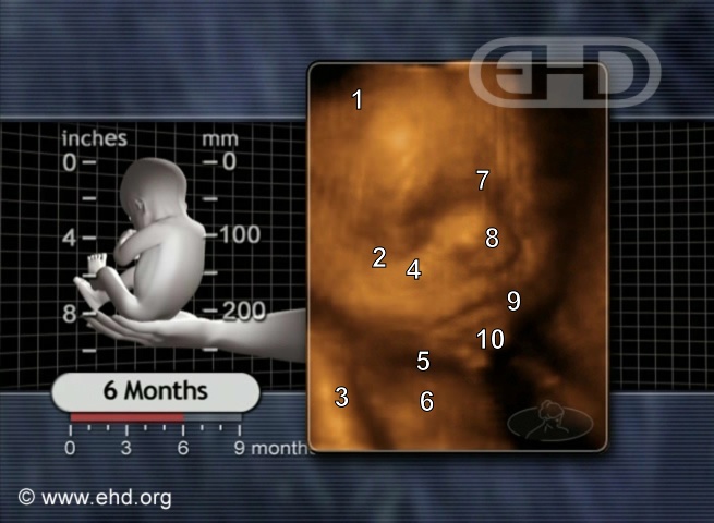 A Face Fetal de 6 Meses [Clique para a próxima imagem]