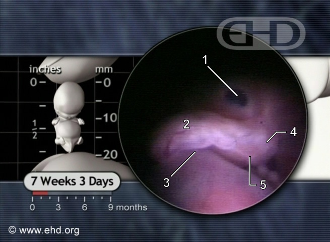 The 7½-Week Face