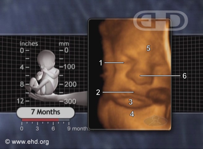 A Face aos 7 Meses [Clique para a próxima imagem]