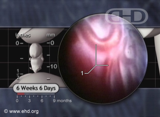 La placenta desde adentro [Haga clic para la siguiente imagen]