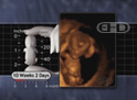 Fetus, 10-Weeks