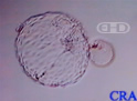 Hatched Blastocyst