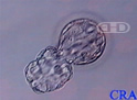 Hatching Blastocyst