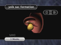 Vista lateral izquierda: embrión de 3 semanas
