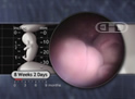 Nariz y boca, embarazo de 8 semanas