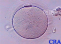 Secondary Oocyte