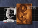 El feto de 10 semanas