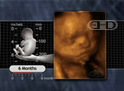 El rostro fetal de 6 meses