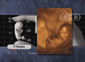 El feto de 9 semanas en movimiento