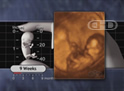 The 9-Week Fetus in Motion