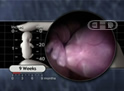El feto de 9 semanas