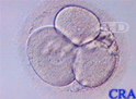 Embrión de tres células